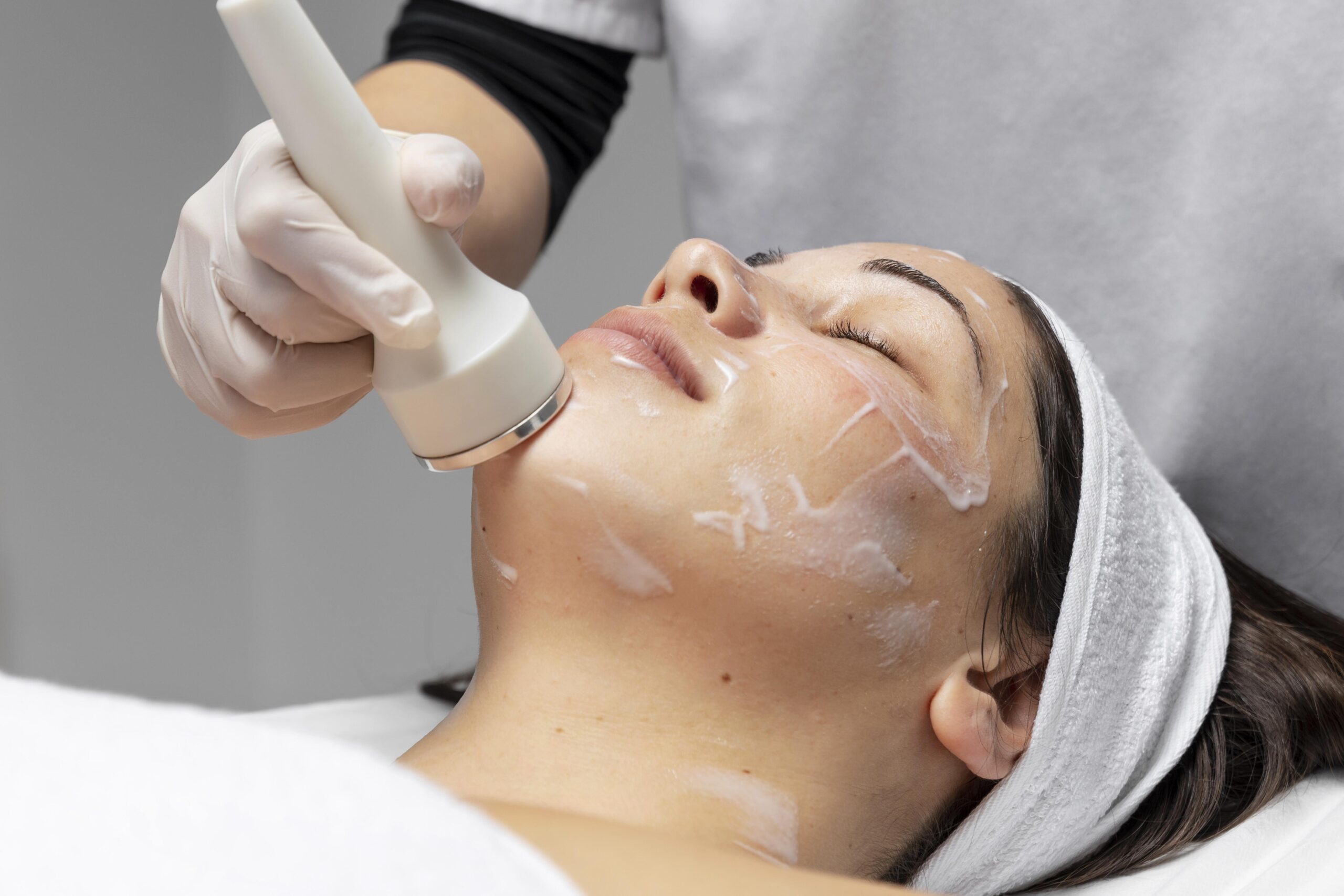 The Role of Chemical Peels in Treating Acne Scars in Victorville, CA