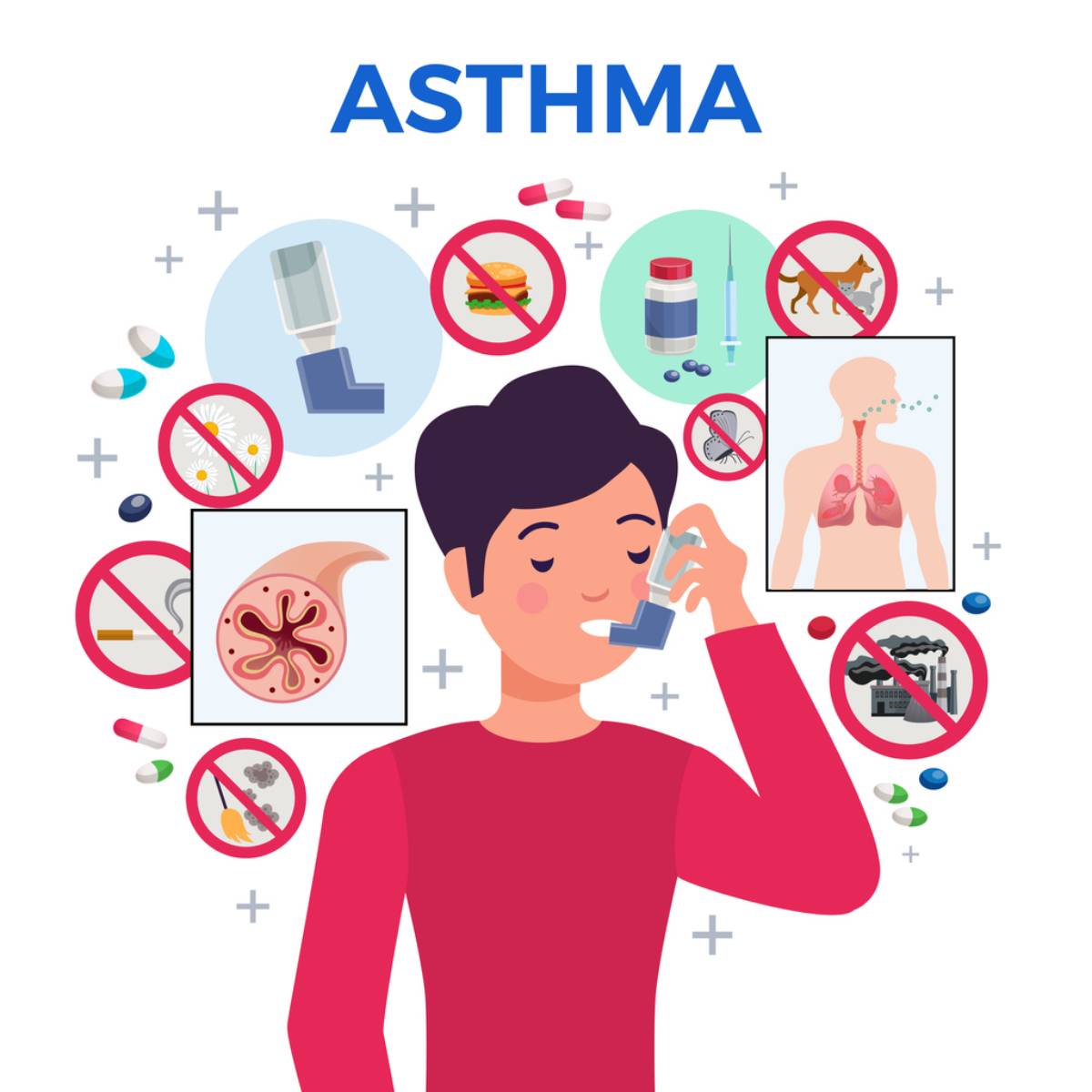 ASTHMA DEVELOPS IN THE LIGHT OF STRESS