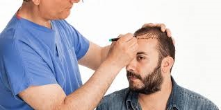 Hair Transplant in Riyadh