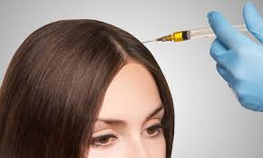 Plasma Injection for Hair in Dubai