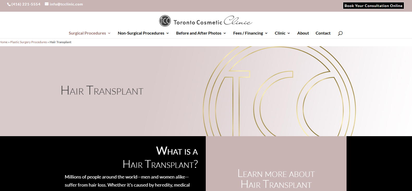 Hair transplant Toronto